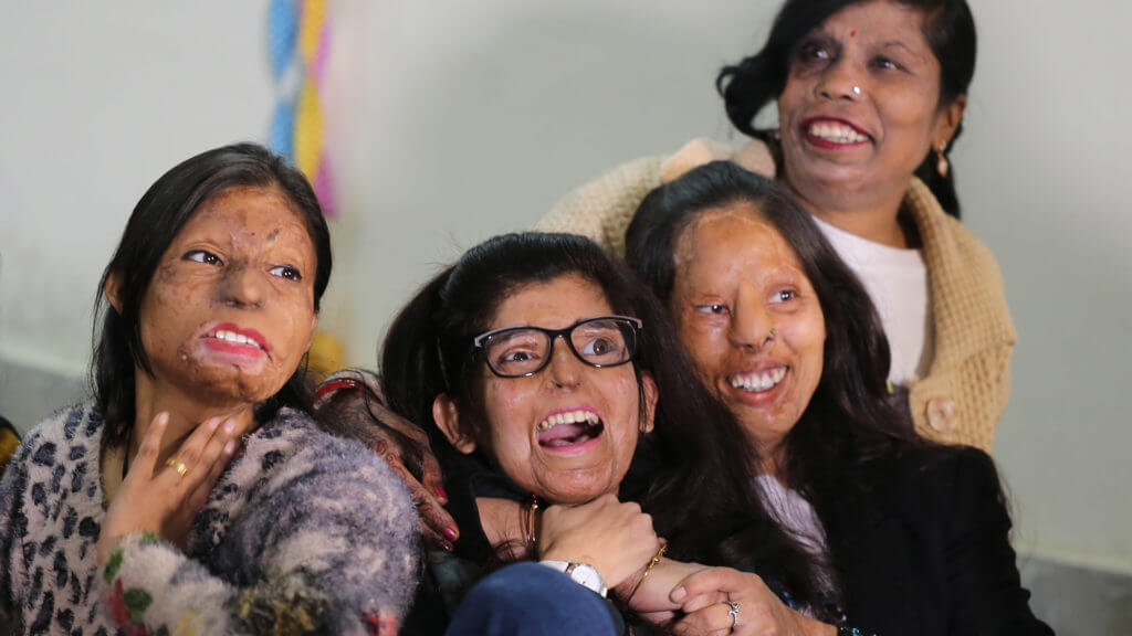 Sheroe's hangou acid attack victims