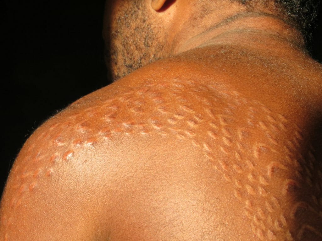 Scarification, Sepik River, Papua New Guinea